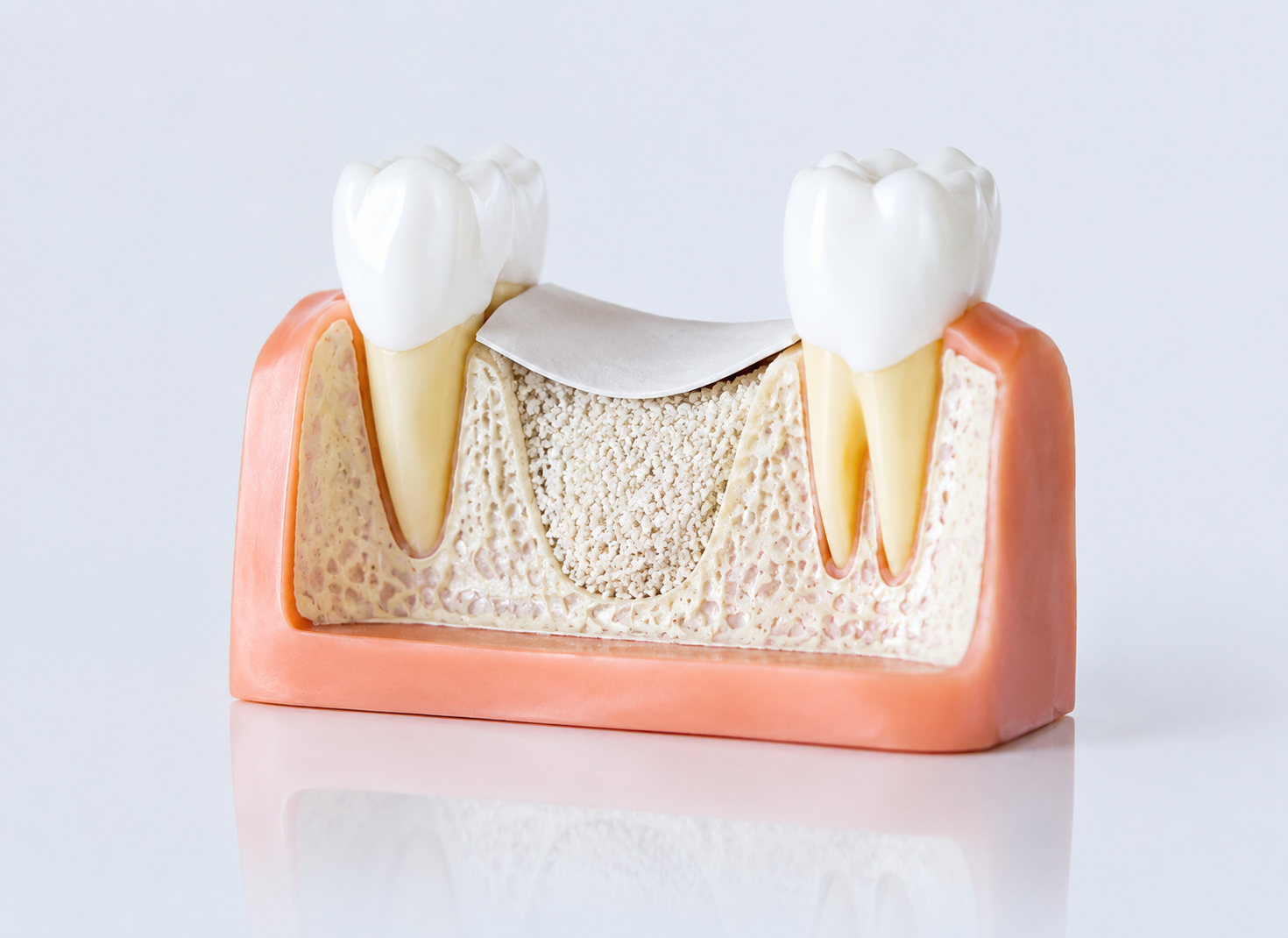 Bone Grafting Procedures – Dr. Devanand Shetty, Bandra Mumbai