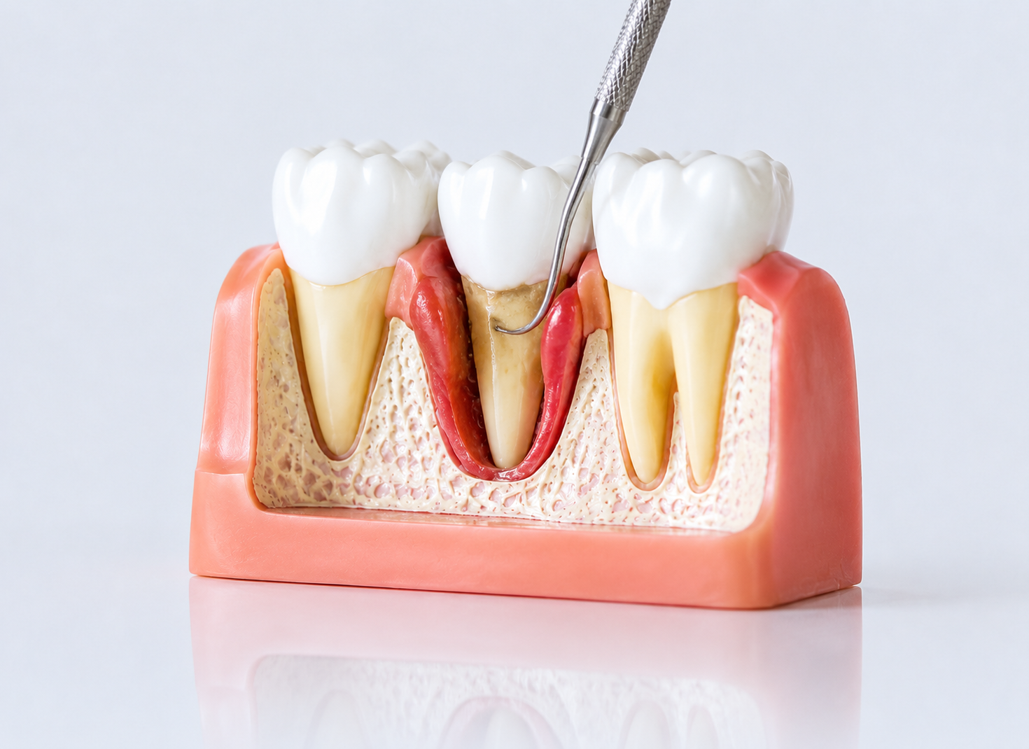 Periodontal Gum Surgery – Dr. Devanand Shetty, Bandra Mumbai